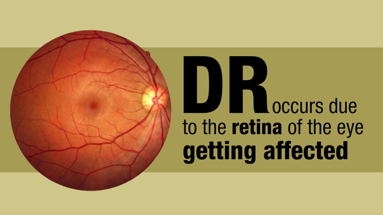 Awareness on Diabetic Retinopathy: The Indian Institute of Public