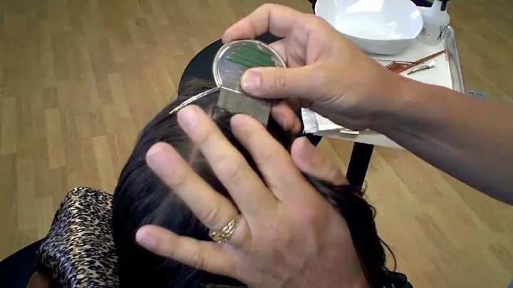 Head Lice Removal Combing Techniques - Lice Control