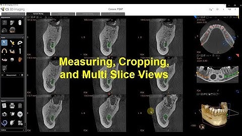 CS 3D Imaging Version 3.10.12 - Implant Planning Part 2 measuring, cropping, 3 X 3 views