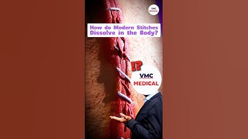How do modern stitches dissolve in the body? By VMC Medical