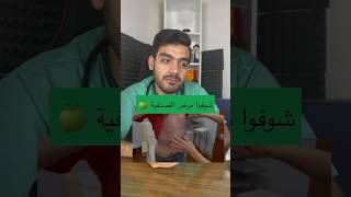 الصدفية دكتور_نبهان learning