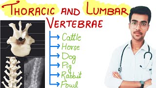 Thoracic and Lumbar Vertebrae || Aniket tyagi 🔥