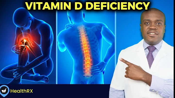 6 Warning Signs Of Low Vitamin D | Signs Of Vitamin D Deficiency