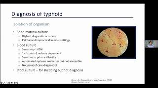 Impact of Typhoid Vaccination in the Community