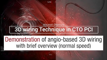 【English】Demonstration of angio-based 3D wiring with brief overview (normal speed)
