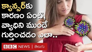 World Cancer Day: క్యాన్సర్‌ కారణాలు ఏమిటి ముందుగా గుర్తించడం ఎలా | BBC Telugu