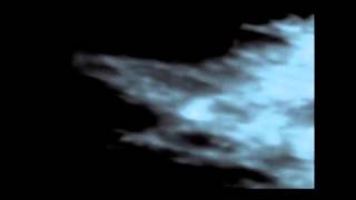 Ciarán Byrne - Blue Gaze