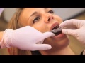 Katharinas successful CA CLEAR ALIGNER treatment