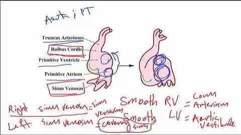 USMLE ACE Video 111: Embryonic development of the heart