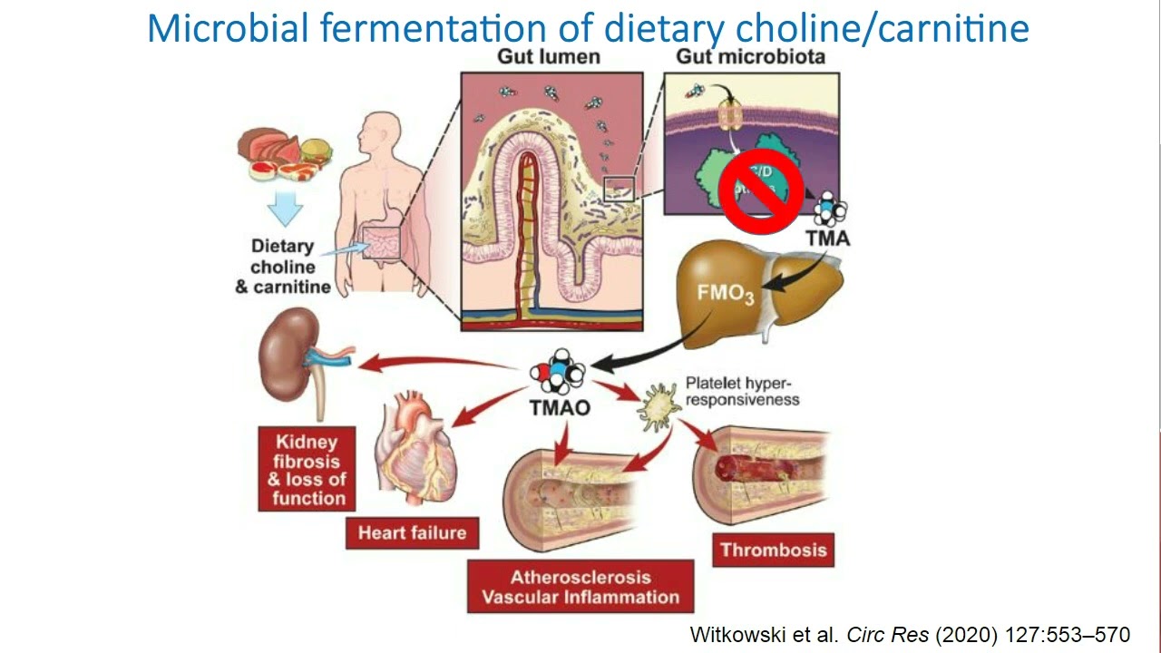 Human Gut Microbiota In Cardiovascular Disease
