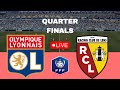 LIVE Lyon Vs Lens Coupe De France Quarter Finals 2026 Full Match LIVE Lyon Vs Lens Coupe De France Quarter Finals 2026 Full Match