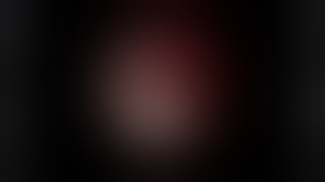 Combined diabetic traction rhegmatogenous detachment