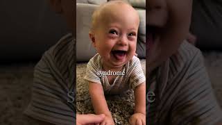 How Having a Down Syndrome Baby Helped His Marriage