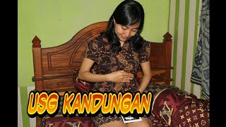 Bumil USG umur kandungan 7 bulan