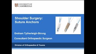 Suture Anchors for Shoulder Surgery