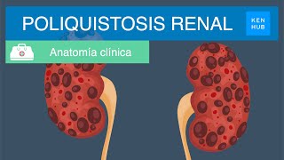 Poliquistosis renal: Definición, causas, síntomas, diagnóstico y tratamiento | Kenhub
