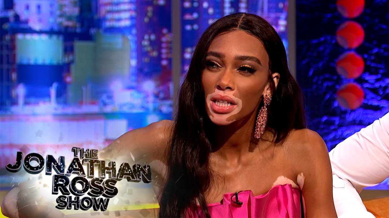Winnie Harlow's First Casting Call Made Her Stronger | The Jonathan Ross Show
