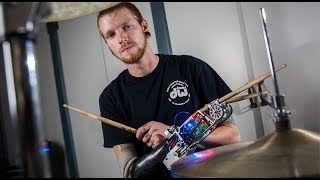 Drummer With Cyborg Arm !!!