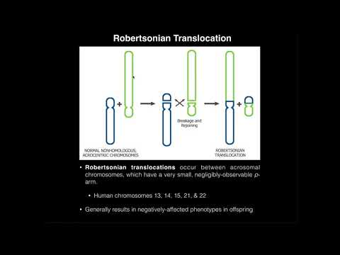 Robertsonian Translocations & Correlation to Down Syndrome