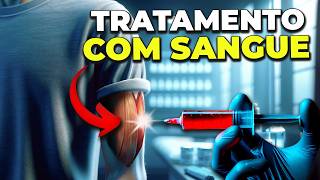 CURA ATRAVÉS DO PRÓPRIO SANGUE: AUTO-HEMOTERAPIA