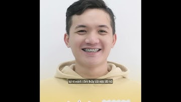 [Review niềng răng] - Kết quả niềng răng móm của Bảo Chương