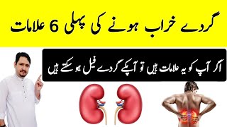 6 Early Warning Signs of Kidney Disease In Urdu Hindi - Gurde Kharab Hone Ki Alamat - Irfan Azeem