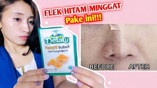 Cara MENGHILANGKAN FLEK HITAM PERMANEN!!! di Rumah aja!!!