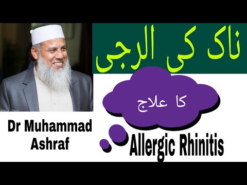 Allergic Rhinitis Symptoms, Diagnosis and treatment  | ناک کی الرجی علامات، تشخیص اور علاج