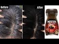 White Hair To Black Permanently in 30 Minutes Naturally | Coffee For Jet Black At Home | 100% Works