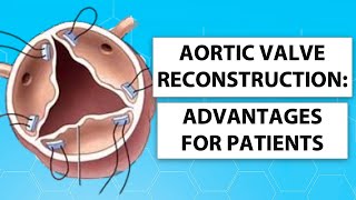 Aortic Valve Reconstruction: Patient Advantages for Keeping Your Own Heart Valve Tissue