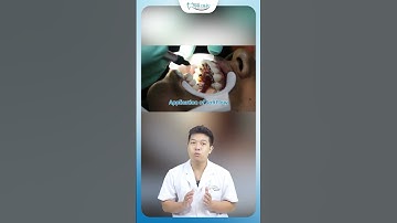 Niềng Răng Mặt Lưỡi | Nha Khoa Minh Châu