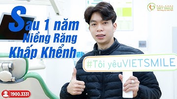 Niềng răng chen chúc, hô, nghiêng mặt phẳng cắn thay đổi ra sao?