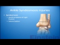 Any consensus on the syndesmosis? An update