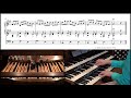 J.S. Bach, BWV 147, 主よ人の望みの喜びよ (楽譜付) Jesus bleibet meine Freude/Joy of Man's Desiring (Sheet music)