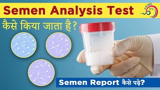 Semen Analysis Test in Hindi | Semen Analysis Normal Report | Semen Analysis Test कैसे किया जाता है Resimi