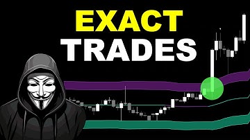 The Signals of This Indicator So ACCURATE, It Feels Like MAGIC! Try it NOW!