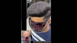 Neno Hair Replacement Treatment