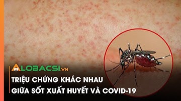 Triệu chứng khác nhau giữa sốt xuất huyết và Covid-19 | Tin nóng Covid-19 hôm nay