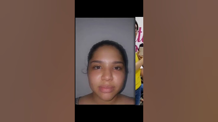 yeri mua ANTES Y DESPUES DE SUS CIRUGIAS