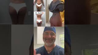 The Natural BBL Jiggle🍑