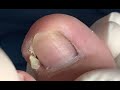 Deep cleaning for nails