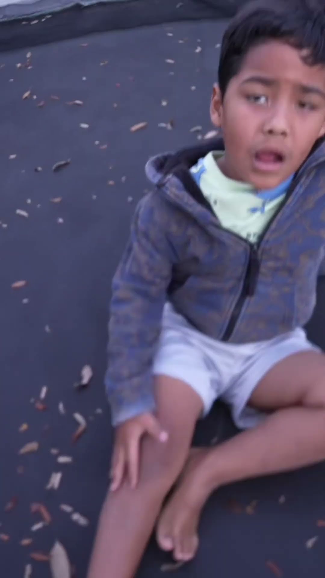 MY SCARY TRAMPOLINE ACCIDENT! #shorts