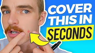 How to Cover a Pimple (In Seconds)