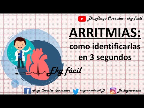 Video: 3 formas de identificar la fibrilación auricular