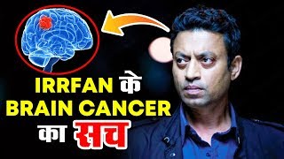 Irrfan Khan Has BRAIN CANCER - Here's The Truth