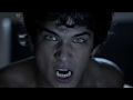 Dark Teen Wolf s1 Logoless Scenes