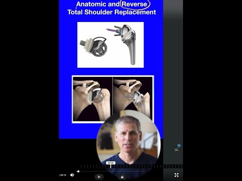 Anatomic v Reverse - YouTube