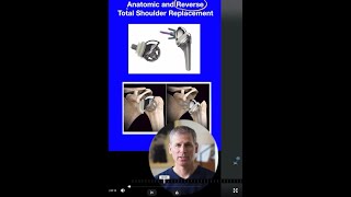 Anatomic v Reverse