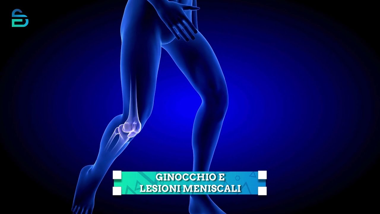 Ginocchio e lesioni meniscali - Dott. Marcello Occhialini - Salute in Prima linea - puntata 17