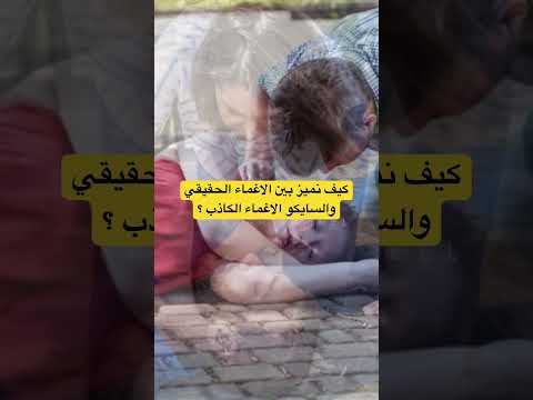 كيف نميز بين الاغماء الحقيقي والسايكو الاغماء الكاذب